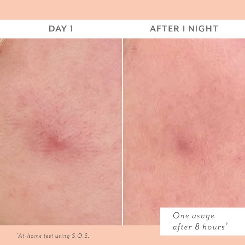 S.O.S. Clarifying Liquid Patch - Patchology