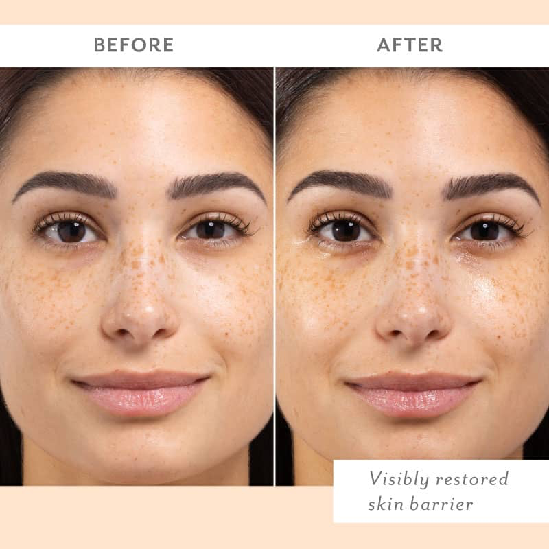 Skin Remedy Barrier-Boosting Sheet Mask Set of 4 - Patchology