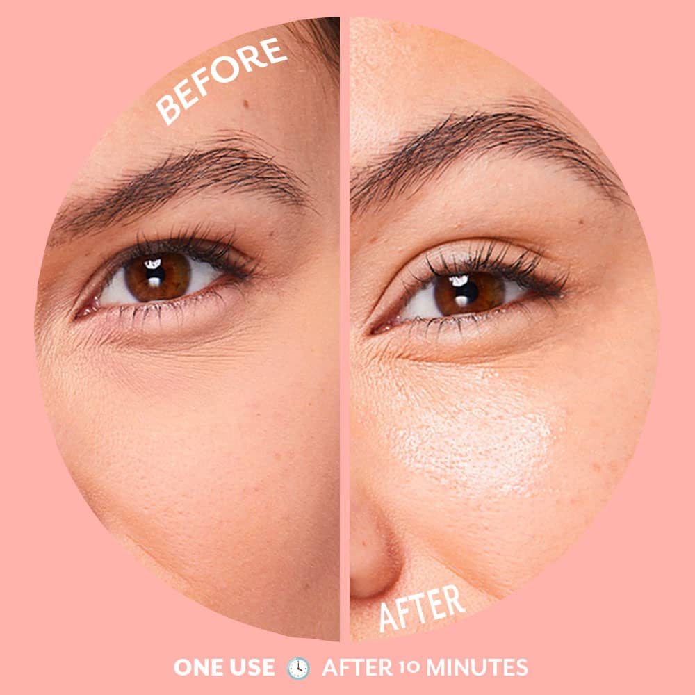 Serve Chilled Bubbly Eye Gels - Patchology