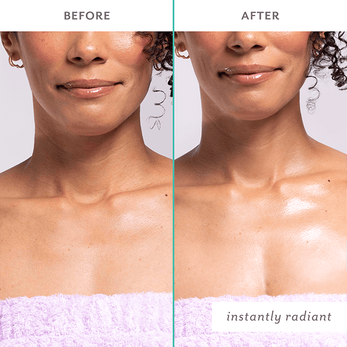 Firm Believer Neck & Décolleté - Patchology