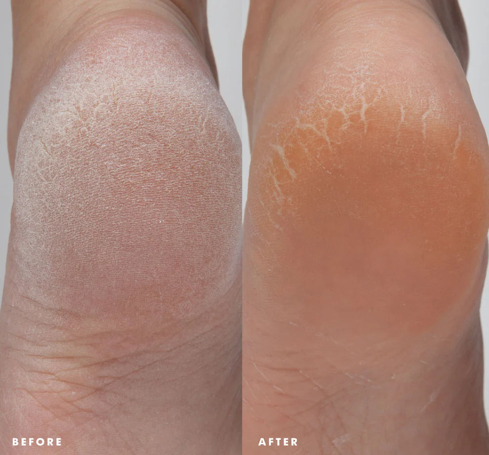 Enrich Mint® Foot Rescue Mask - FarmHouse Fresh